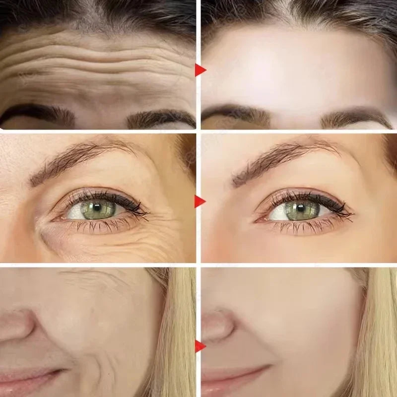 Eelhoe Vitamin E Capsule Serum – Anti-Aging, Firming & Fine Line Fading Face Serum