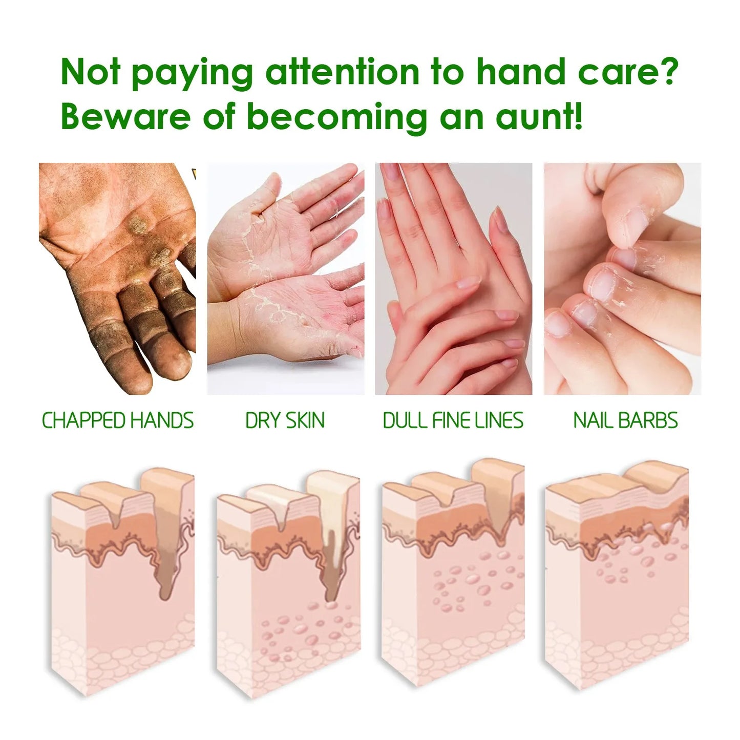 Eelhoe Nourishing Foot Cream – Dry Crack Repair, Dead Skin Removal & Deep Moisturizer 100g