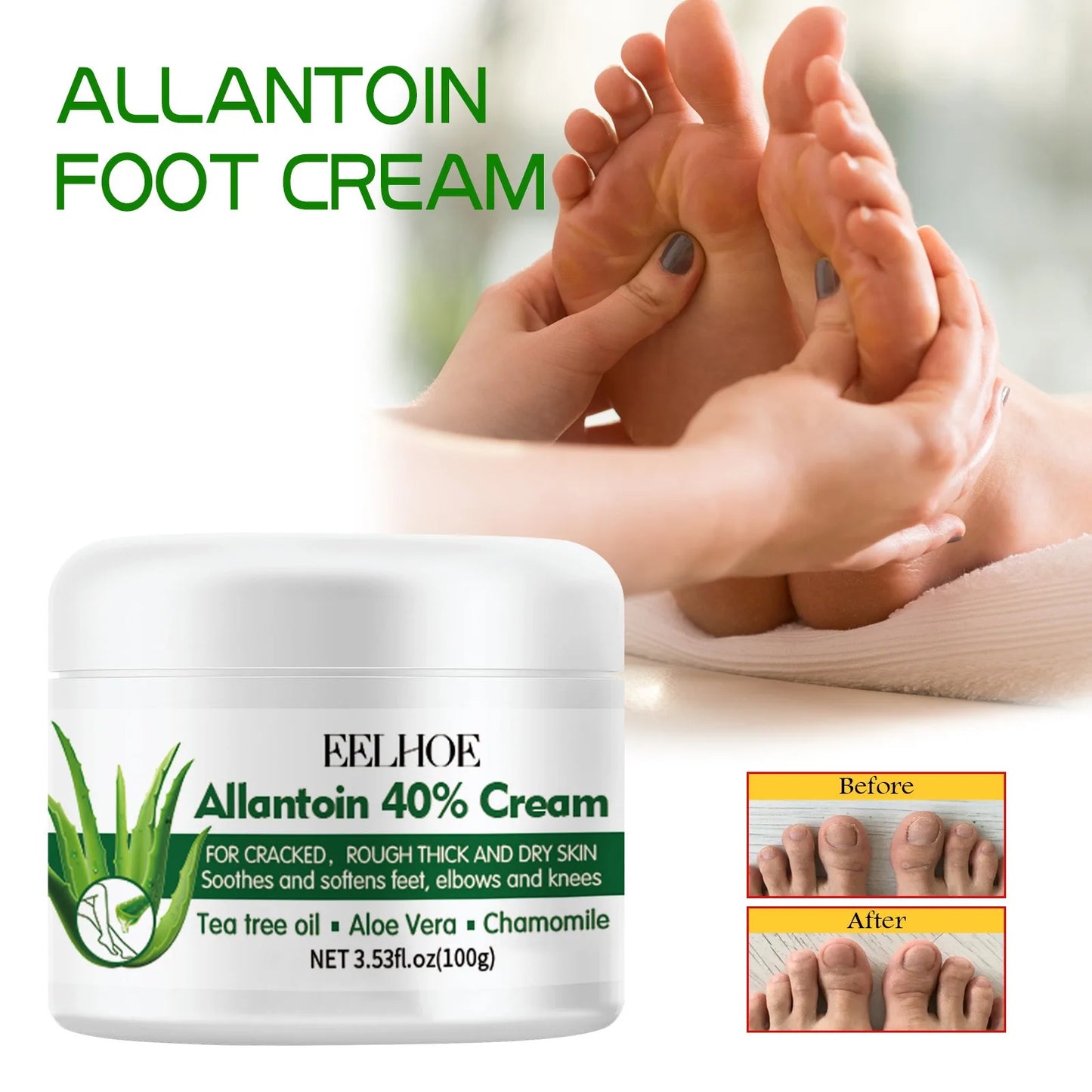 Eelhoe Nourishing Foot Cream – Dry Crack Repair, Dead Skin Removal & Deep Moisturizer 100g