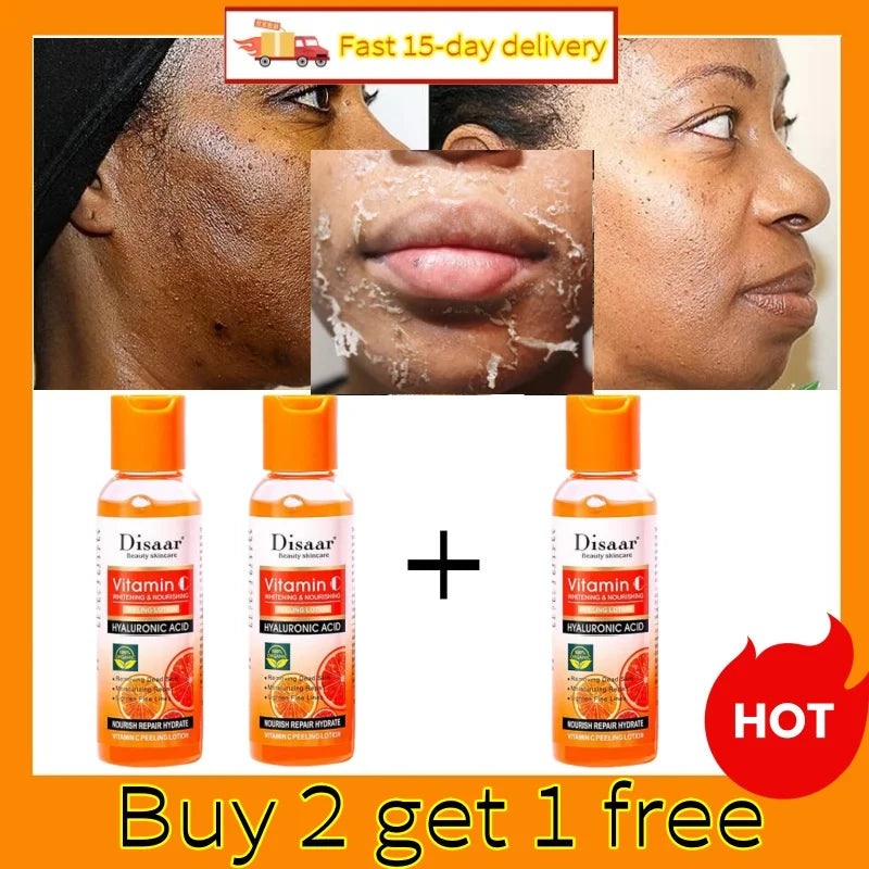 PWYUMAN Yellow Peeling Lotion – Exfoliating & Brightening Body Scrub with Vitamin C & Hyaluronic Acid 100ml